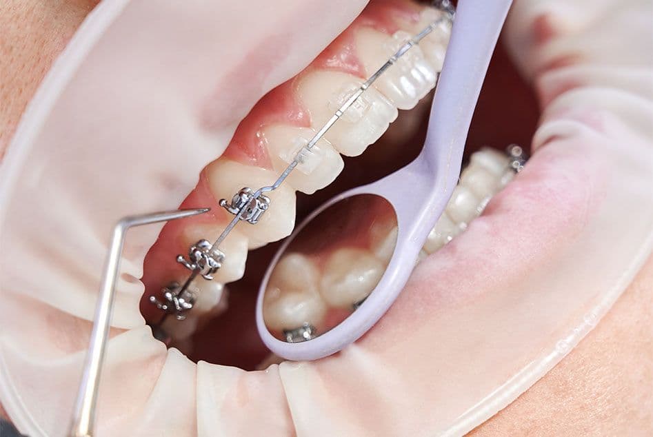 Universal Smile Dental